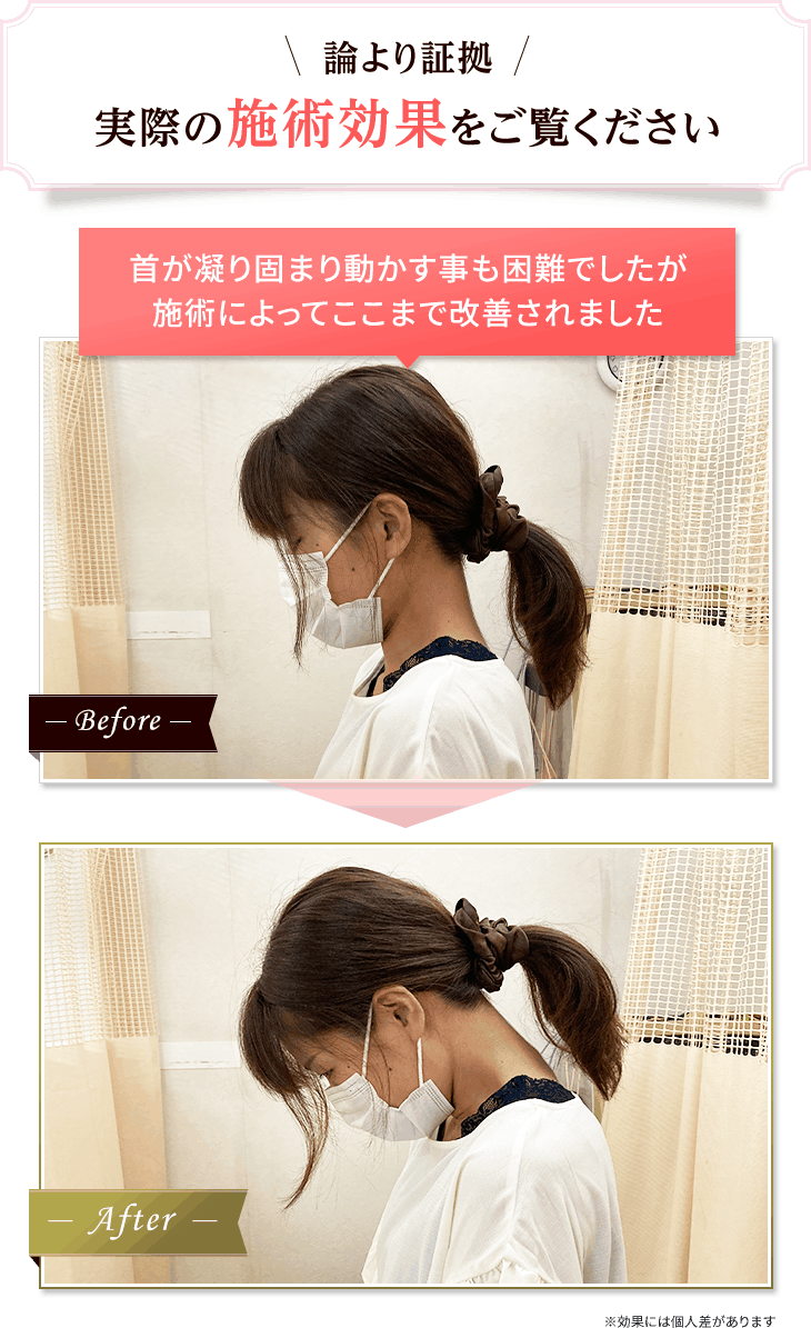 門真市で人気の整体高木整骨院に来院したお客差のビフォーアフター
