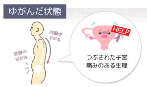 生理痛の改善